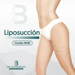 Liposucción en panamá 3 Liposucción
